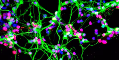 Neurons growing in a culture dish (NASA)